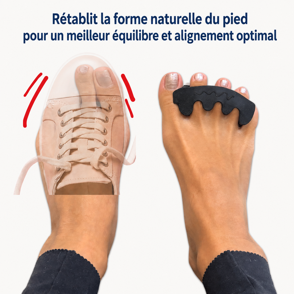 Motion Toes